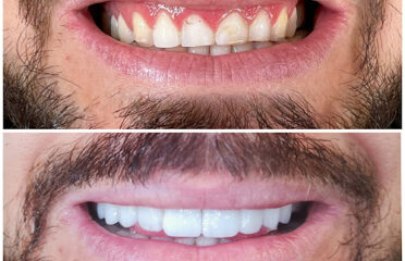 Dental C -Klinikë Dentare