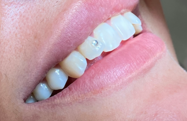 Dental Plus Clinic